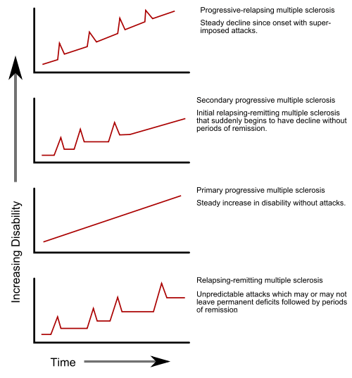 Multiple sclerosis subtypes